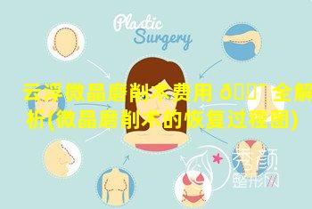 云浮微晶磨削术费用 🐯 全解析(微晶磨削术的恢复过程图)